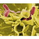 Muestra Imagen 1.Bacteria salmonella