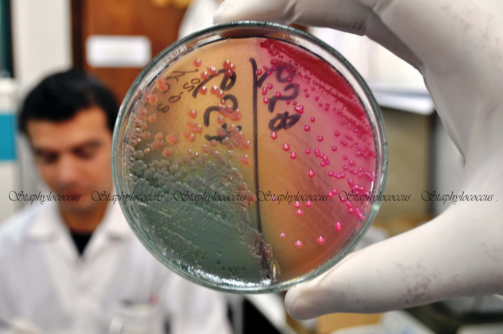 Bacterias en una placa de Petri