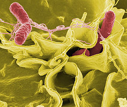 Bacterias de la Salmonella (células rojas) invadiendo células humanas